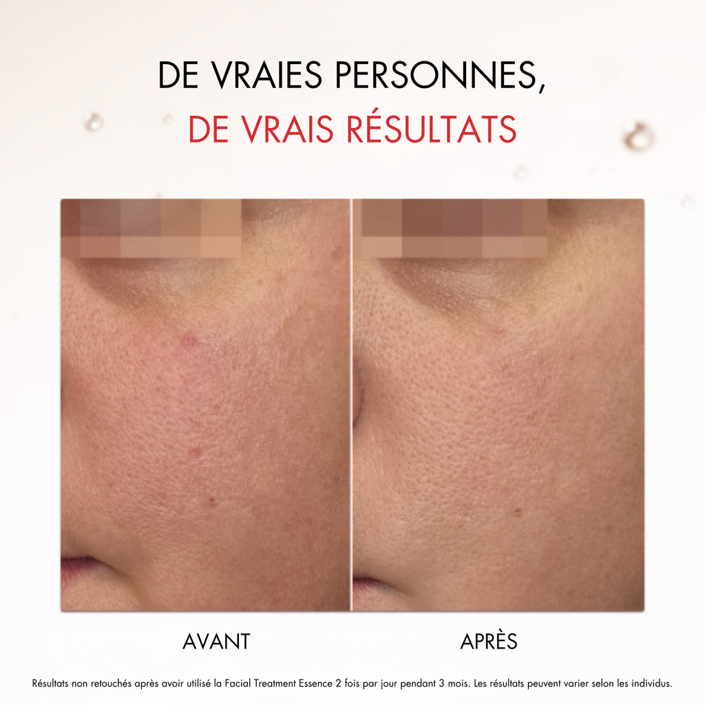 SK‑II Facial Treatment Essence